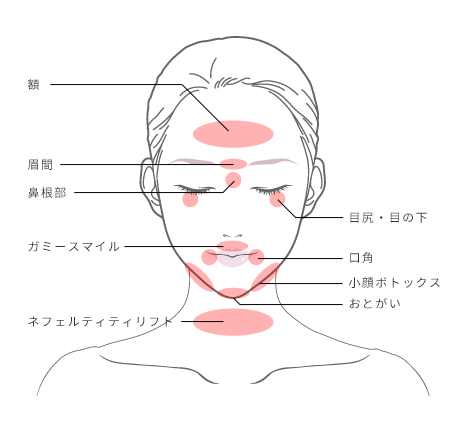 ボトックス注射 | セレクトクリニック